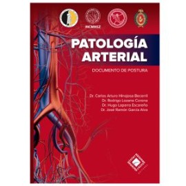 Patología arterial